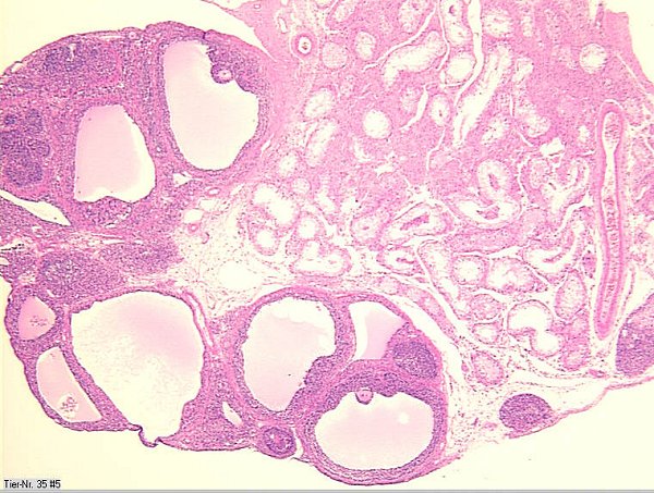 Case # 8, Fig. 4