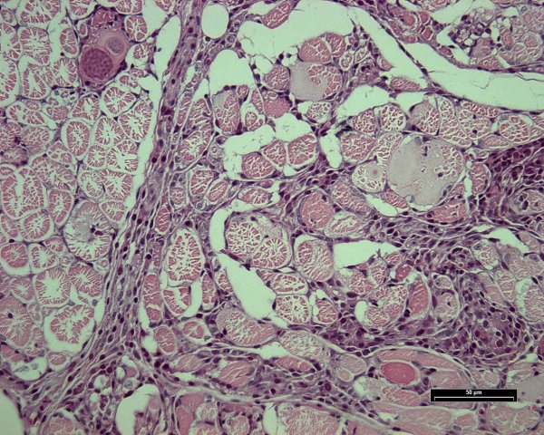 Case # 9, Fig. 2