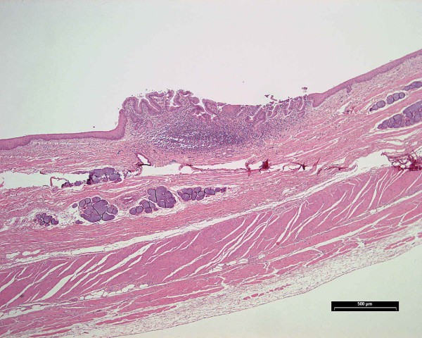 Case # 14, Fig. 2