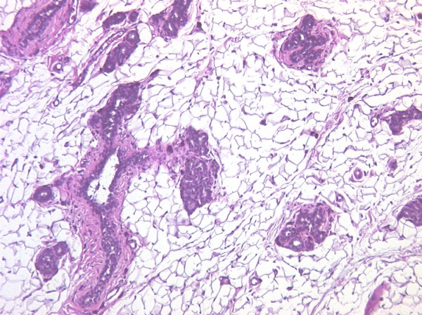 Case # 3, Fig. 2 treated