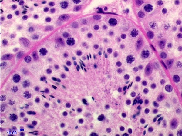 Case # 4, Fig. 2: Biopsy, treated animal before study