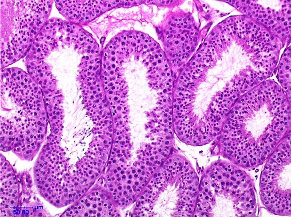 Case # 4, Fig. 3: Control testis after 13 weeks