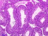 Case 4, Fig. 3: Control testis after 13 weeks