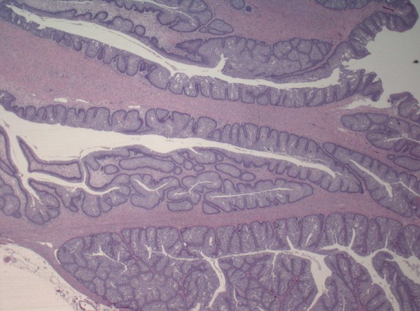 Case # 6, Fig. 3 (6c)