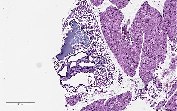 Case No 1, Fig. 1