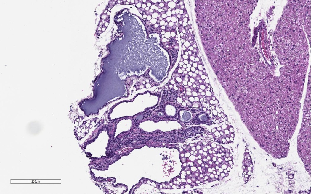 Case No 1, Fig. 2