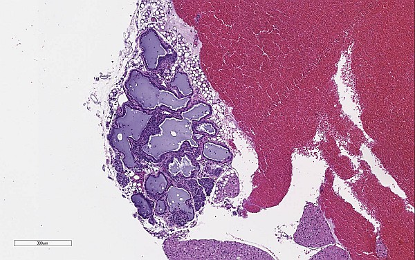 Case No 1, Fig. 5