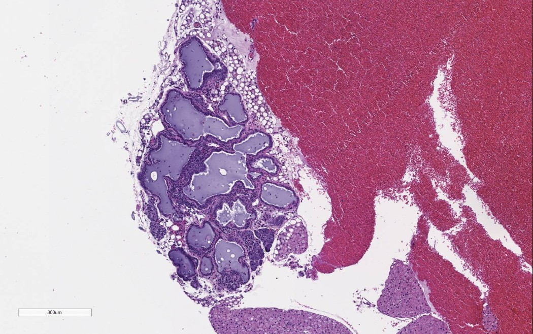 Case No 1, Fig. 5