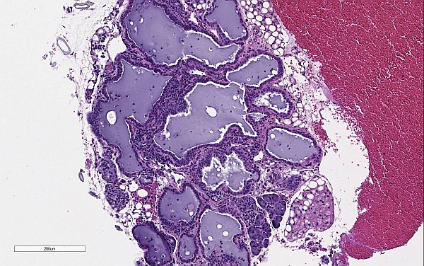 Case No 1, Fig. 6