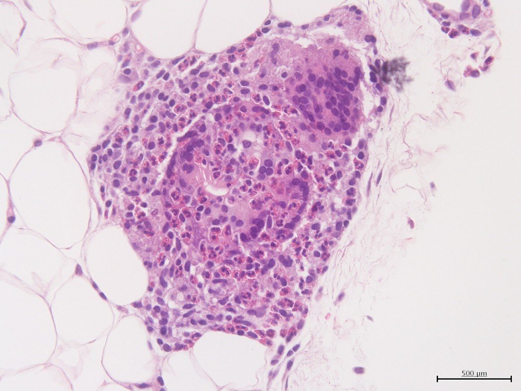 Case No 2, Fig. 6