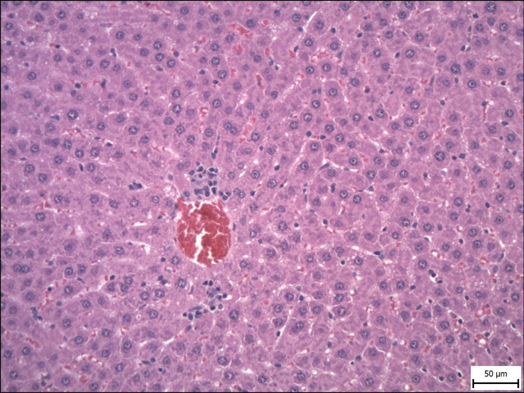 Case No 3, Fig. 2