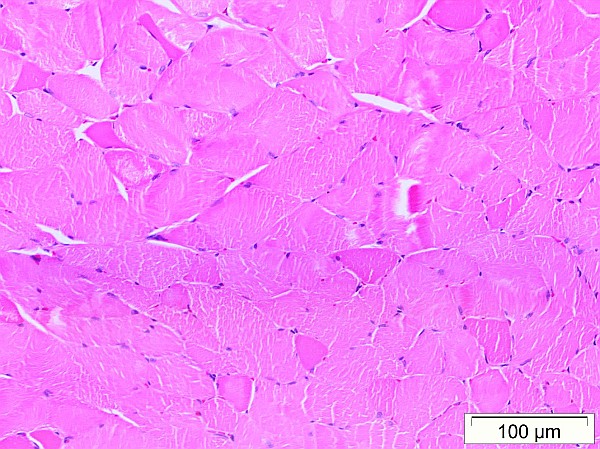 Case No 4, Fig. 1