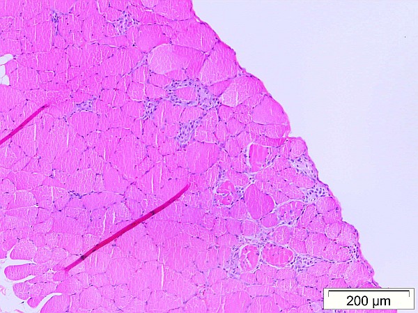 Case No 4, Fig. 5